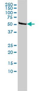 DLD Antibody in Western Blot (WB)