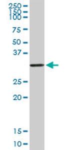 DLX1 Antibody in Western Blot (WB)