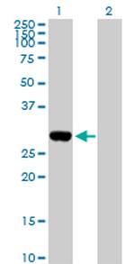 DLX1 Antibody in Western Blot (WB)