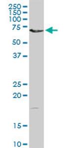 DMPK Antibody in Western Blot (WB)