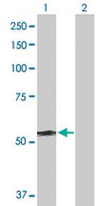 DYNC1LI2 Antibody in Western Blot (WB)