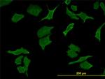 DPYD Antibody in Immunocytochemistry (ICC/IF)