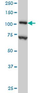 DPYD Antibody in Western Blot (WB)