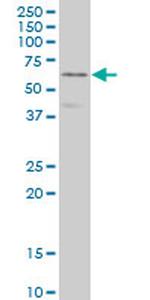 DPYSL3 Antibody in Western Blot (WB)