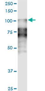 DSC2 Antibody in Western Blot (WB)