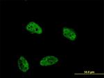 DUSP4 Antibody in Immunocytochemistry (ICC/IF)