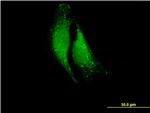 ELA1 Antibody in Immunocytochemistry (ICC/IF)