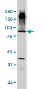 EML1 Antibody in Western Blot (WB)