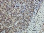 EMP3 Antibody in Immunohistochemistry (Paraffin) (IHC (P))