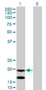 EMP3 Antibody in Western Blot (WB)