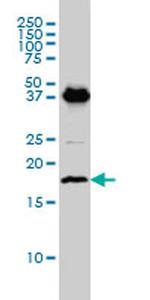 EMP3 Antibody in Western Blot (WB)