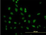 ERCC2 Antibody in Immunocytochemistry (ICC/IF)