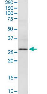 EXTL2 Antibody in Western Blot (WB)