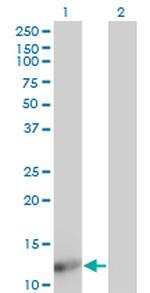 FABP4 Antibody in Western Blot (WB)