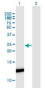 FABP7 Antibody in Western Blot (WB)