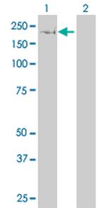 FASN Antibody in Western Blot (WB)