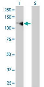 FGFR1 Antibody in Western Blot (WB)