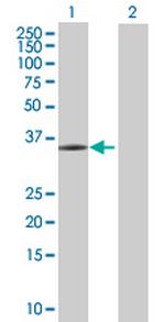 FGL1 Antibody in Western Blot (WB)