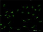 FOXC2 Antibody in Immunocytochemistry (ICC/IF)