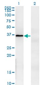 FRZB Antibody in Western Blot (WB)