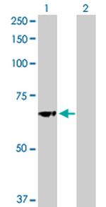 GBA Antibody in Western Blot (WB)