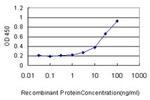 GBA Antibody in ELISA (ELISA)