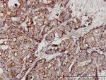 GBA Antibody in Immunohistochemistry (Paraffin) (IHC (P))