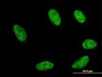 GBX2 Antibody in Immunocytochemistry (ICC/IF)