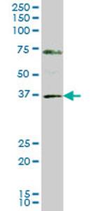 GBX2 Antibody in Western Blot (WB)