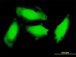 GCH1 Antibody in Immunocytochemistry (ICC/IF)