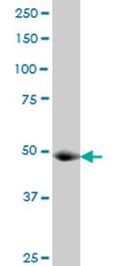 GCN5L2 Antibody in Western Blot (WB)