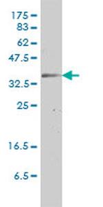 GJB3 Antibody in Western Blot (WB)