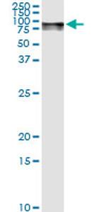 GLB1 Antibody in Immunoprecipitation (IP)