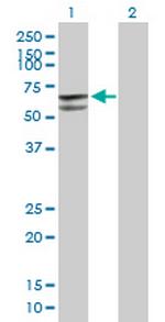 GLUD2 Antibody in Western Blot (WB)