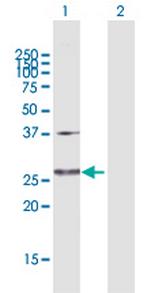 GLUD2 Antibody in Western Blot (WB)