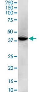 GNAQ Antibody in Western Blot (WB)