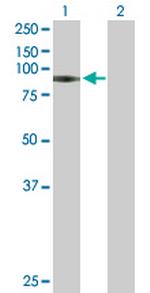 GNS Antibody in Western Blot (WB)