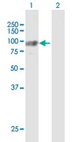 GNS Antibody in Western Blot (WB)