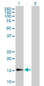 GPLD1 Antibody in Western Blot (WB)