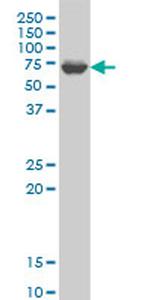 GRK6 Antibody in Western Blot (WB)