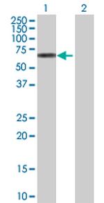 GRB7 Antibody in Western Blot (WB)