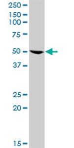 GRB7 Antibody in Western Blot (WB)