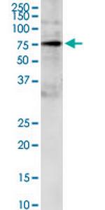 GRB10 Antibody in Western Blot (WB)