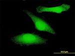 GSK3B Antibody in Immunocytochemistry (ICC/IF)