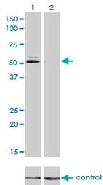 GSR Antibody in Western Blot (WB)