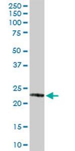 GSTP1 Antibody in Western Blot (WB)