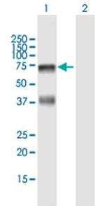 HABP2 Antibody in Western Blot (WB)