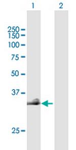 HAS3 Antibody in Western Blot (WB)