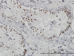 HDAC1 Antibody in Immunohistochemistry (Paraffin) (IHC (P))