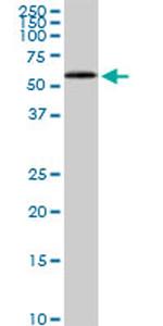 HDAC1 Antibody in Western Blot (WB)